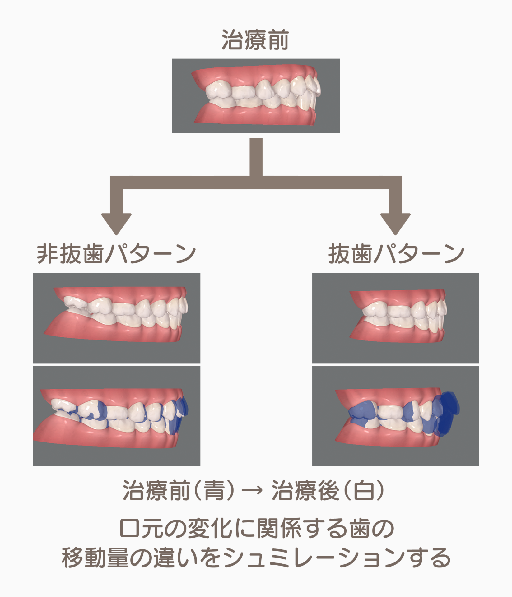患者様のニーズに合わせた多様なシミュレーションプラン（選択肢）のご提示